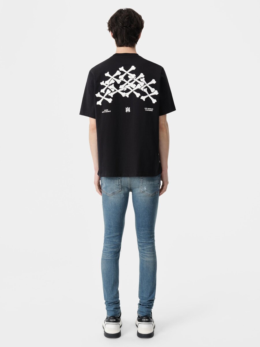 MX1
